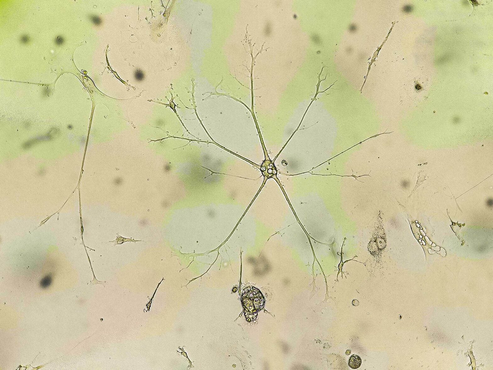 Cultivo celular de glioblastoma observado al microscopio para estudiar la fotoinmunomodulación con conjugados péptido-fotosensibilizador.